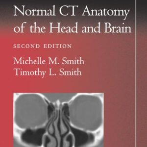 Pocket Atlas of Normal CT Anatomy of the Head and Brain (Radiology Pocket Atlas Series)