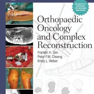 Master Techniques in Orthopaedic Surgery: Orthopaedic Oncology and Complex Reconstruction