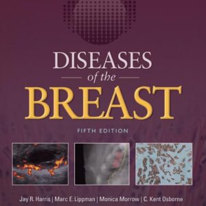 Diseases of the Breast 5e