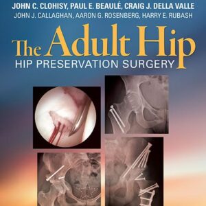 The Adult Hip: Hip Preservation Surgery