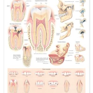 Disorders of the Teeth and Jaw Anatomical Chart