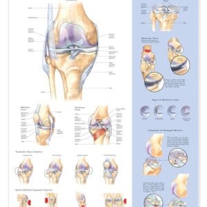 Knee Injuries Anatomical Chart