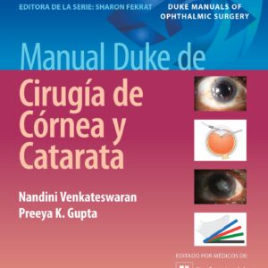 Manual Duke de cirugía de córnea y catarata (Spanish Edition)