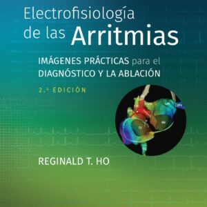 Electrofisiología de las arritmias: Imágenes prácticas para el diagnóstico y la ablación (Spanish Edition)