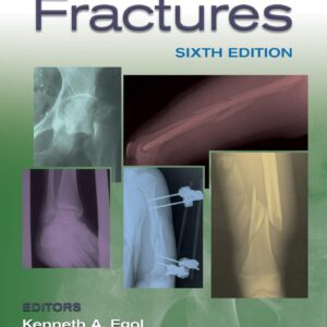Handbook of Fractures