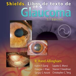 Shields. Libro de texto de Glaucoma (Spanish Edition)