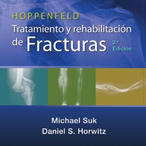 Hoppenfeld. Tratamiento y rehabilitación de fracturas (Spanish Edition)