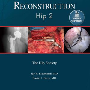 Advanced Reconstruction: Hip 2: Print + Ebook with Multimedia (AAOS - American Academy of Orthopaedic Surgeons)