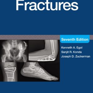 Handbook of Fractures: Print + eBook with Multimedia