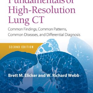 Fundamentals of High-Resolution Lung CT: Common Findings