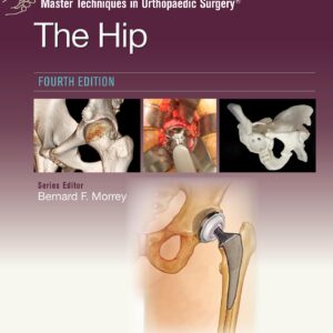 Master Techniques in Orthopaedic Surgery: The Hip: Print + eBook with Multimedia
