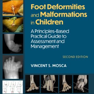 Foot Deformities and Malformations in Children: A Principles-Based