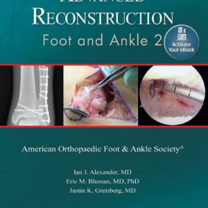 Advanced Reconstruction: Foot and Ankle 2: Print + Ebook (AAOS - American Academy of Orthopaedic Surgeons)