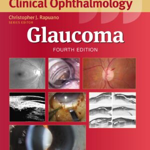 Glaucoma (Wills Eye Institute Atlas Series)