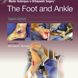 Master Techniques in Orthopaedic Surgery: The Foot and Ankle: Print + eBook with Multimedia