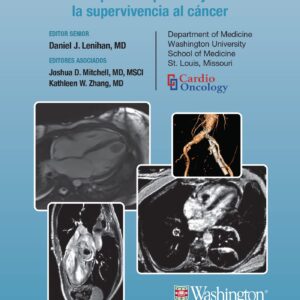 Manual Washington de Cardiooncología: Guía práctica para mejorar la supervivencia al cáncer (Spanish Edition)