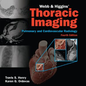 Webb & Higgins Thoracic Imaging: Print + eBook with Multimedia