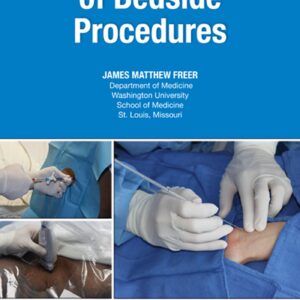 The Washington Manual of Bedside Procedures