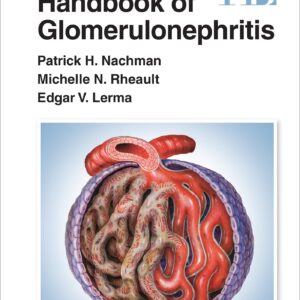 Handbook of Glomerulonephritis