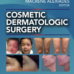 Cosmetic Dermatologic Surgery