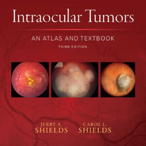 Intraocular Tumors: An Atlas and Textbook (Volume 1)