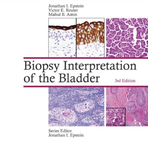 Biopsy Interpretation of the Bladder