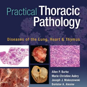 Practical Thoracic Pathology: Diseases of the Lung