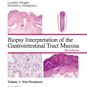 Biopsy Interpretation of the Gastrointestinal Tract Mucosa Volume 1: Non-Neoplastic: Print + eBook with Multimedia (Volume 1)
