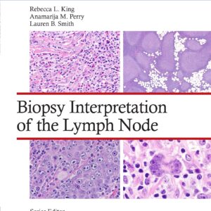 Biopsy Interpretation of the Lymph Node: Print + eBook with Multimedia