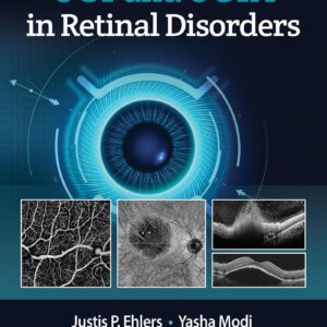 OCT and OCTA in Retinal Disorders