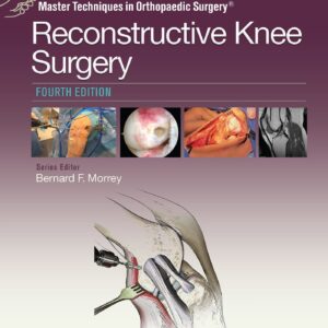 Master Techniques in Orthopaedic Surgery: Reconstructive Knee Surgery