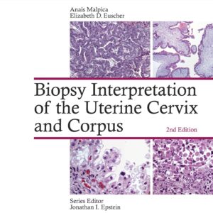 Biopsy Interpretation of the Uterine Cervix and Corpus (Biopsy Interpretation Series)