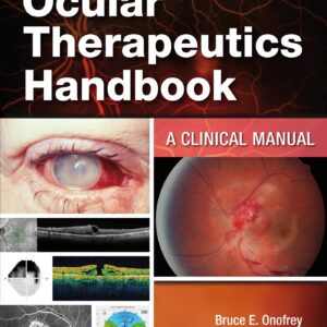 Ocular Therapeutics Handbook: A Clinical Manual