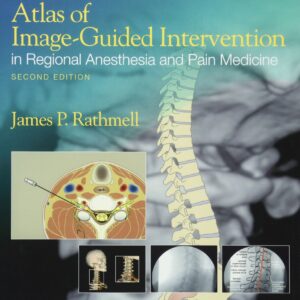 Atlas of Image-Guided Intervention in Regional Anesthesia and Pain Medicine
