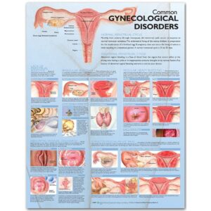 Common Gynecological Disorders Anatomical Chart