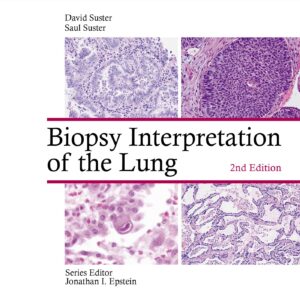 Biopsy Interpretation of the Lung (Biopsy Interpretation Series)