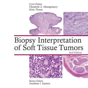 Biopsy Interpretation of Soft Tissue Tumors (Biopsy Interpretation Series)