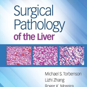 Surgical Pathology of the Liver