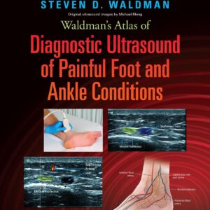 Waldman's Atlas of Diagnostic Ultrasound of Painful Foot and Ankle Conditions