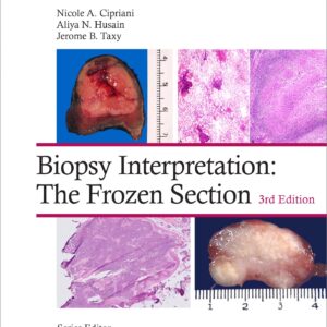 Biopsy Interpretation: The Frozen Section: Print + eBook with Multimedia