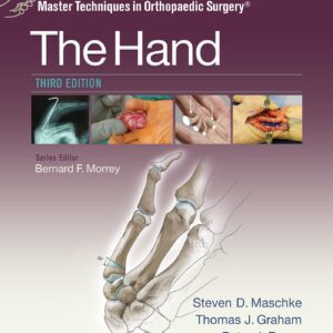 Master Techniques in Orthopaedic Surgery: The Hand