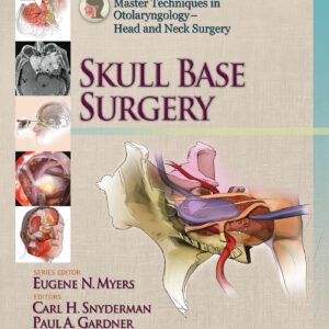 Master Techniques in Otolaryngology - Head and Neck Surgery: Skull Base Surgery