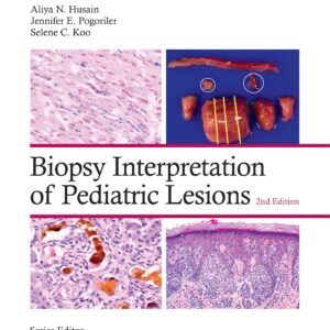 Biopsy Interpretation of Pediatric Lesions: Print + eBook with Multimedia (Biopsy Interpretation Series)