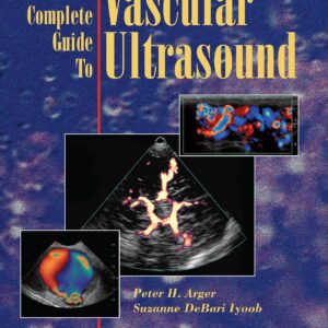 The Complete Guide to Vascular Ultrasound