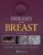 Diseases of the Breast 5e – ISBN-10: 1451186274