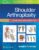 Shoulder Arthroplasty: Principles and Practice – ISBN-10: 1975157664