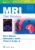 MRI: The Basics – ISBN-10: 1496384326