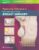 Prepectoral Techniques in Reconstructive Breast Surgery – ISBN-10: 1496388275