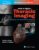 Webb & Higgins Thoracic Imaging: Print + eBook with Multimedia – ISBN-10: 1975199383
