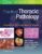 Practical Thoracic Pathology: Diseases of the Lung, Heart, and Thymus – ISBN-10: 1451193513